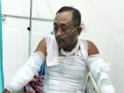 Penjual Siomay Alami Luka Bakar di Sekujur Tubuh Akibat Ceceran Pasir di Jalan